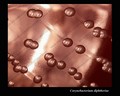 corynebacterium diphtheriae